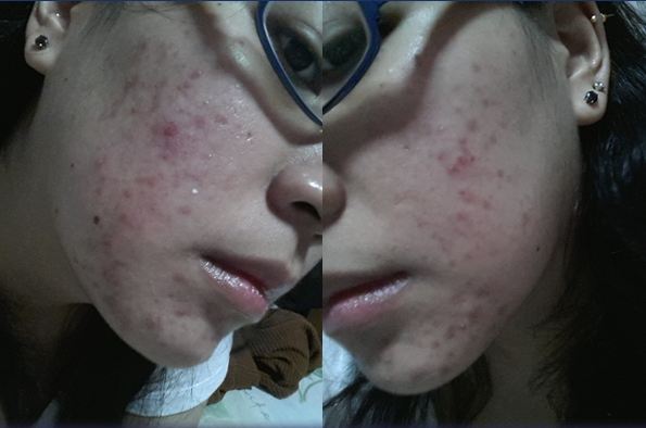 เคล็ดลับความสวย