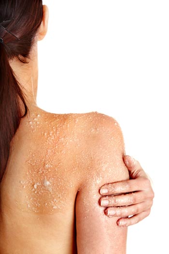 เคล็ดลับผิวสวย