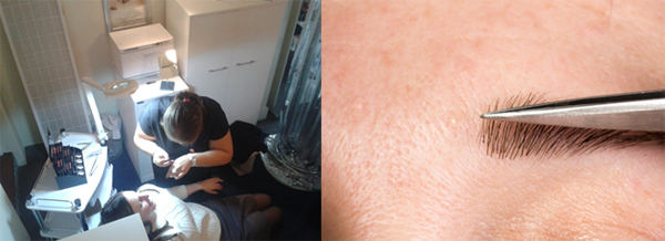 ปลูกคิ้ว