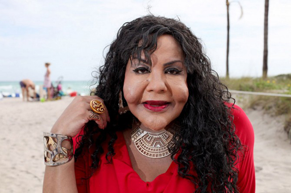 ฟิลเลอร์