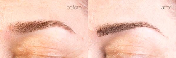 ปลูกคิ้ว