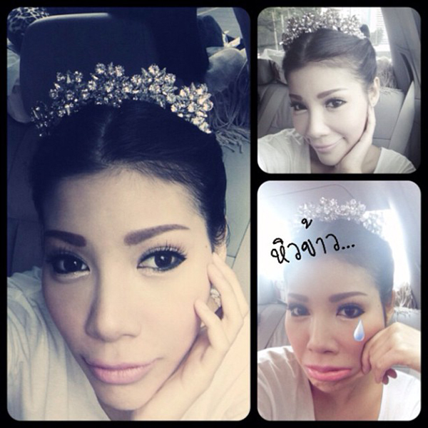 ดาราทำจมูก