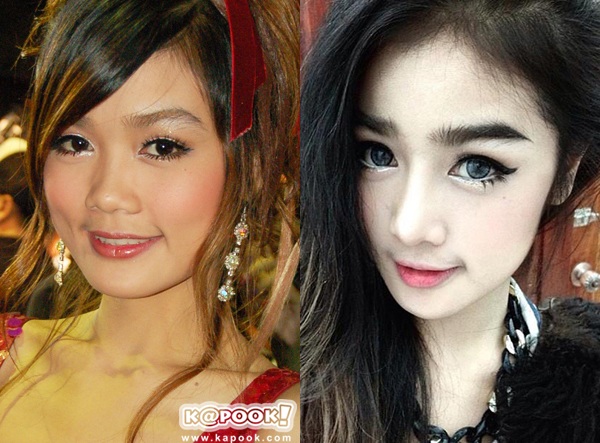 นักร้องลูกทุ่งศัลยกรรม