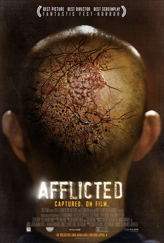 หลอนได้อีก ตัวอย่าง Afflicted หนังอินดี้สุดแนว 