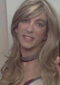 จากชายกลายเป็นหญิง เพราะผลข้างเคียงของยาปลูกผม