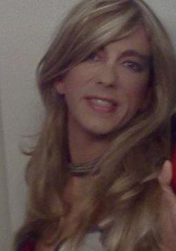 จากชายกลายเป็นหญิง เพราะผลข้างเคียงของยาปลูกผม