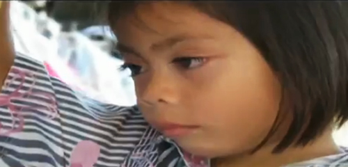 โลนนับร้อยฝังในขอบตาเด็กหญิง 3 ขวบ