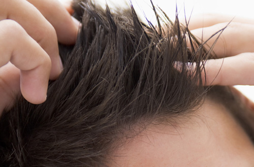 วิธีดูแลเส้นผม ผู้ชาย