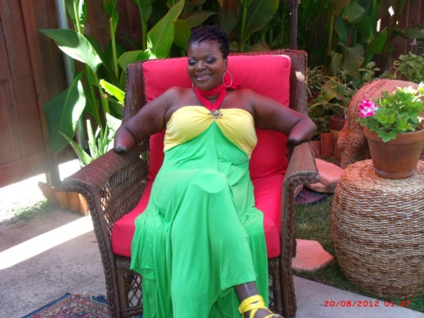 เตือนใจ! หญิงมะกันต้องตัดมือ-เท้า รักษาชีวิต หลังเสริมบั้นท้ายเถื่อน