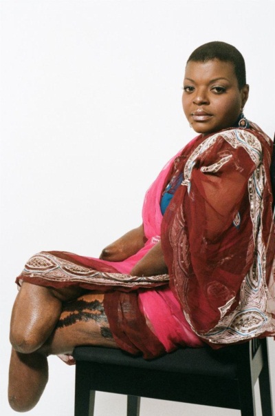 เตือนใจ! หญิงมะกันต้องตัดมือ-เท้า รักษาชีวิต หลังเสริมบั้นท้ายเถื่อน